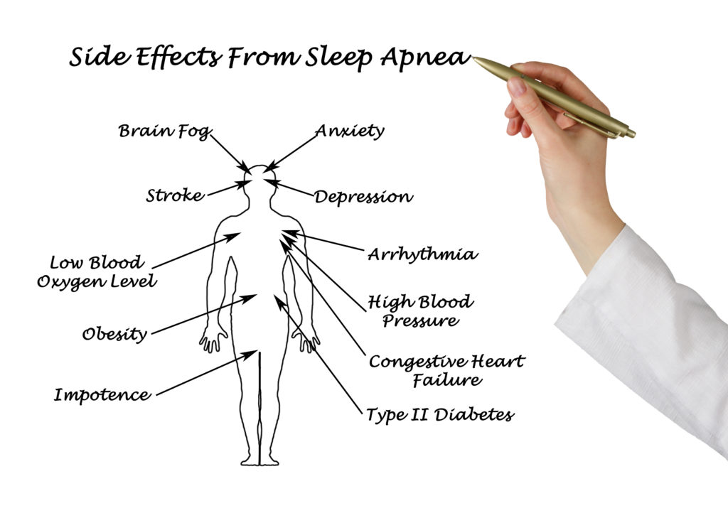 Sleep apnea side effects