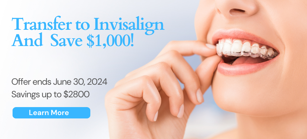 172 nyc dental offers $1000 discount off Invisalign treatment fee for patients who want to from another clear retainers treatment to Invisalign. This offer is valid until June 30, 2024